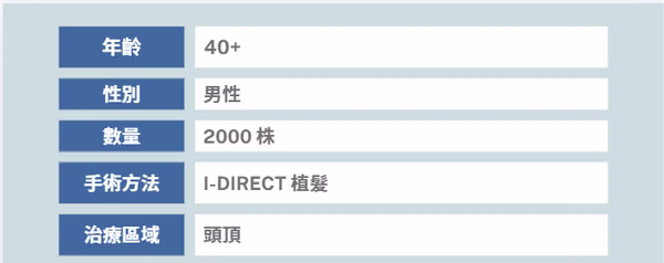 頭頂植髮個案二 (2000株) - 術後