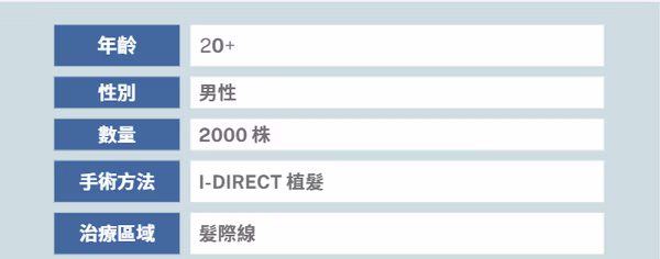 髮際線植髮個案三 (2000株) - 植髮後