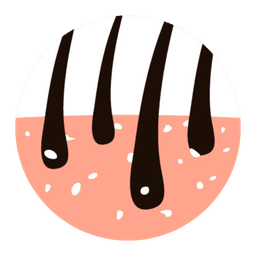 減少頭癬及皮屑