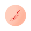 穩定的疤痕性脫髮