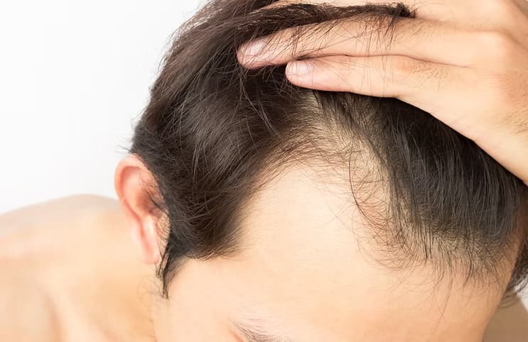 預防脫髮、改善髮質