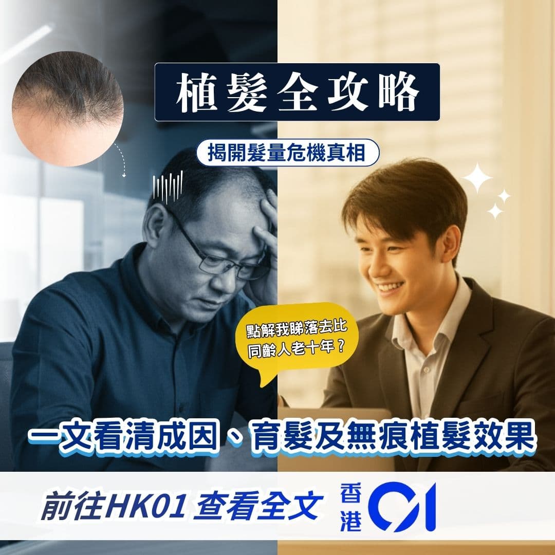 HK01 報導 - 植髮全攻略