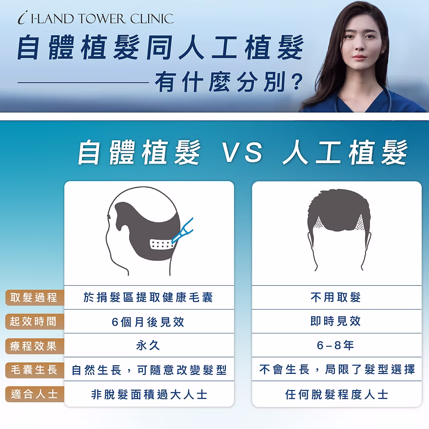 自體植髮與人工植髮的詳細比較圖表