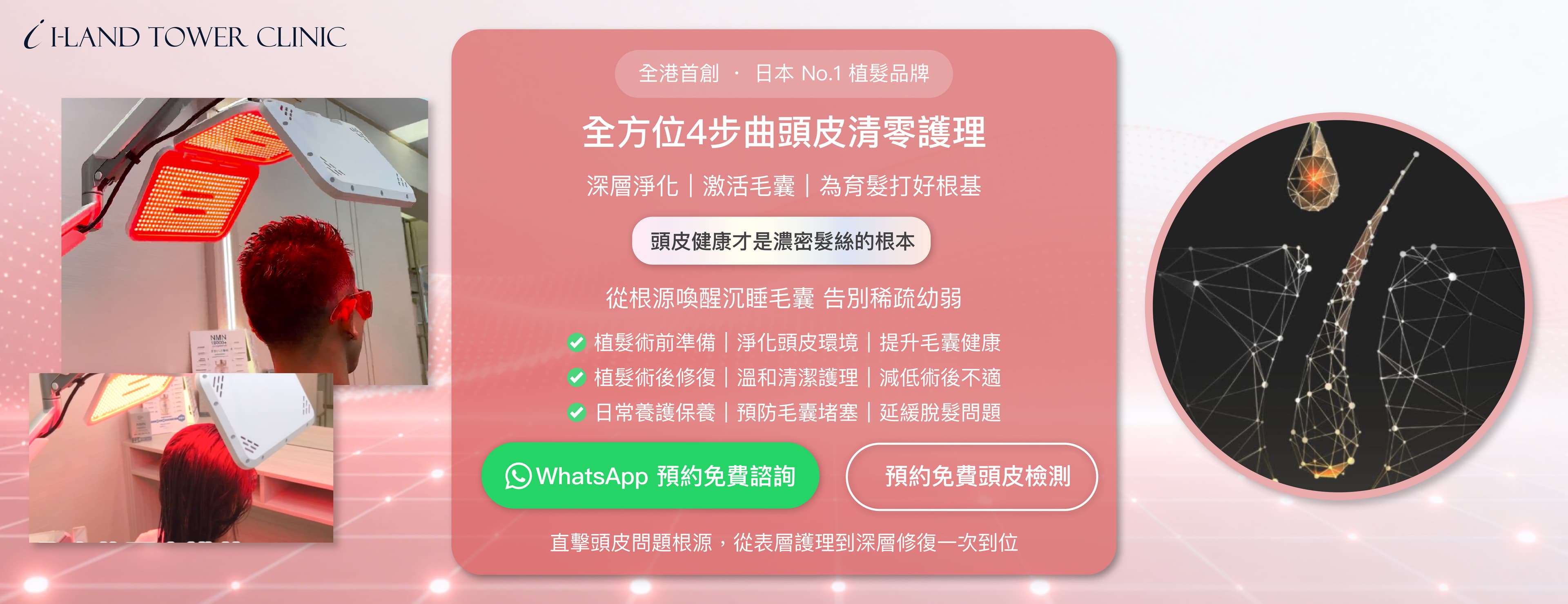 全方位4步曲頭皮清零護理
