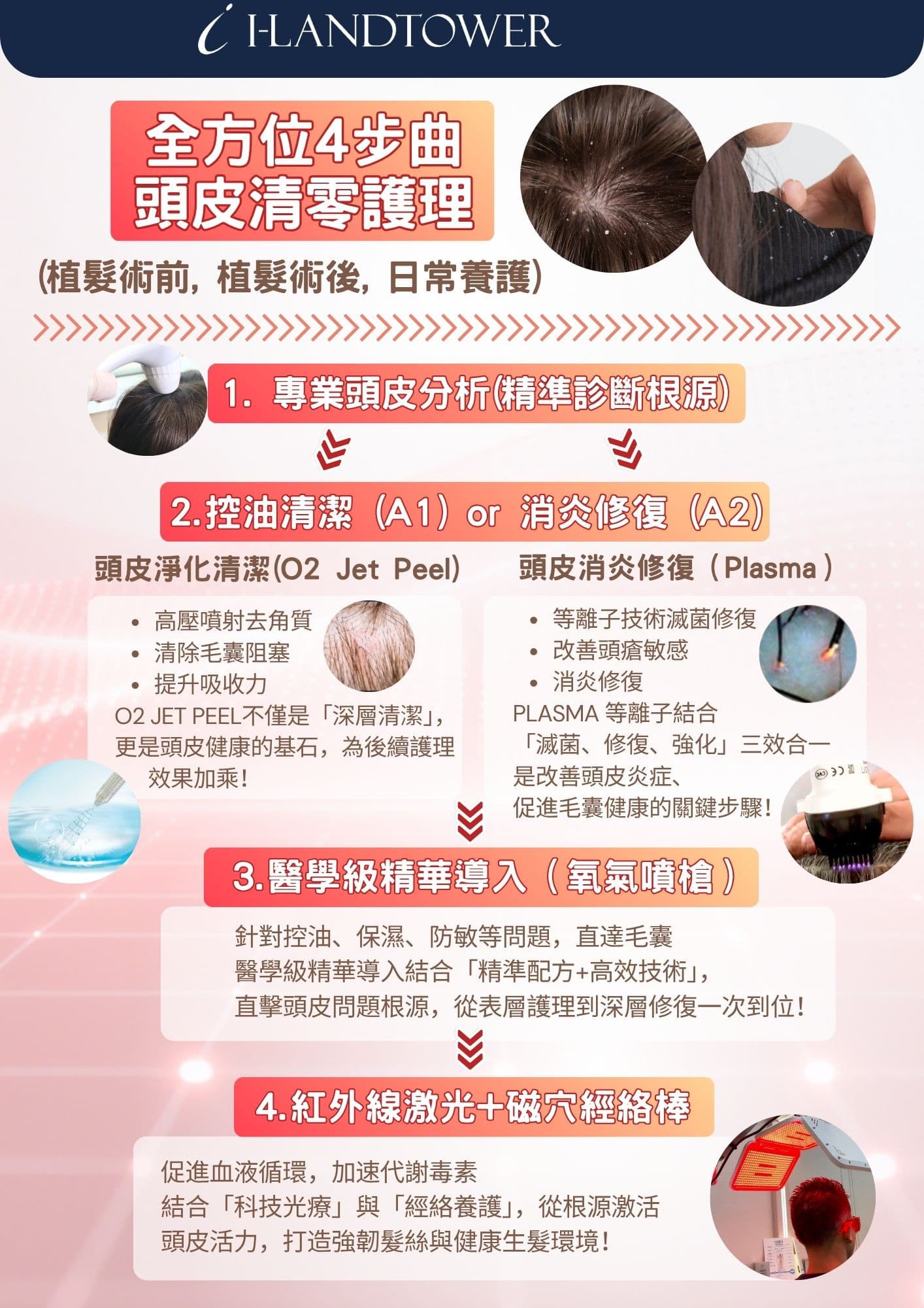全方位4步曲頭皮清零護理流程總覽