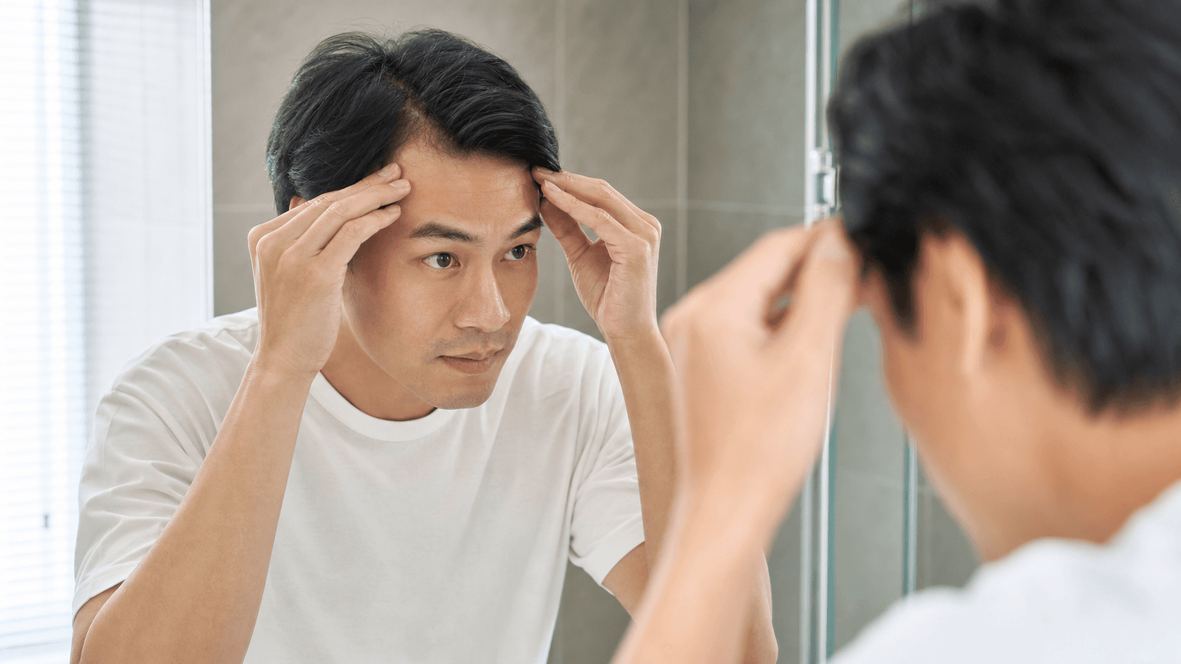 男士照鏡檢查 M 字額初期及髮際線後移情況