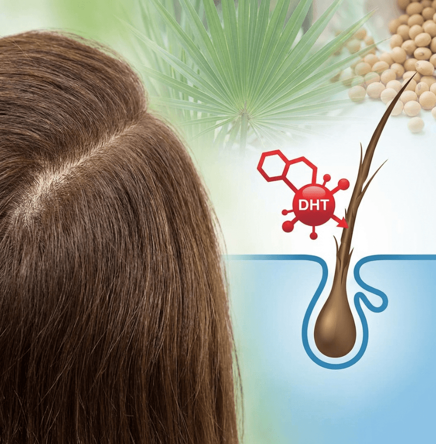 【脫髮自救】為何髮線越來越稀疏?解構雄性脫髮成因與天然對策