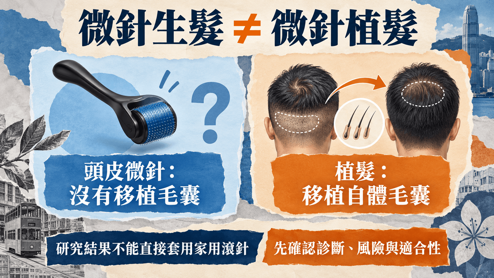 微針生髮是刺激頭皮,微針植髮是移植毛囊,不能自行照搬研究療程